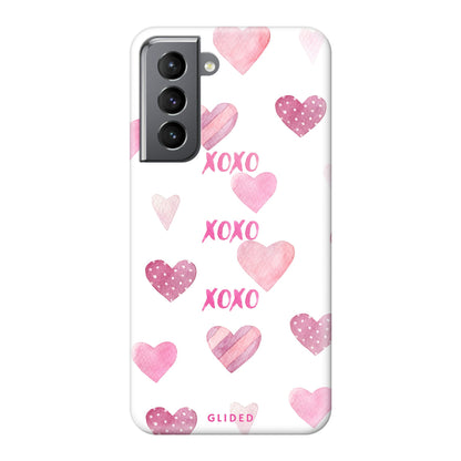 Xoxo - Samsung Galaxy S21 5G - Hard Case